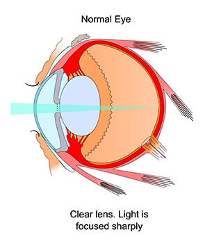 Healthy Eye Diagram