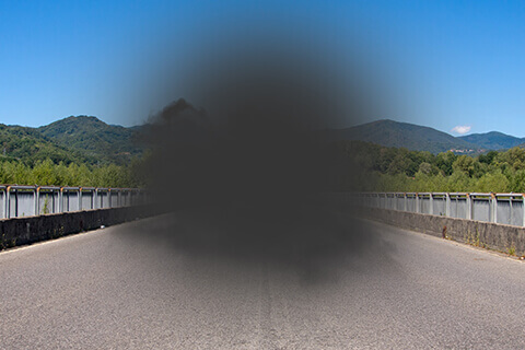Vision with macular degeneration simulation